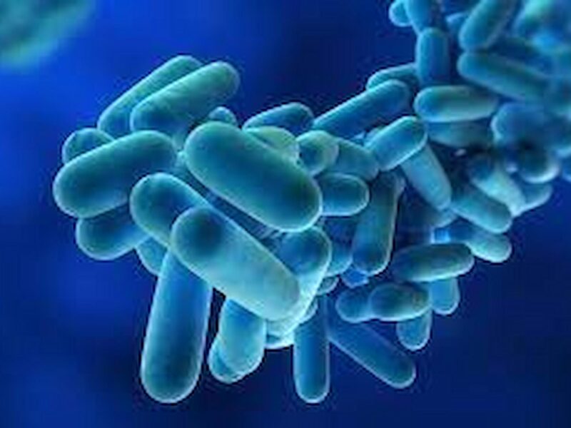 Useful Tips from Legionella Experts